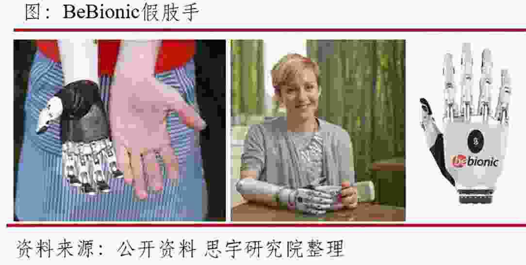 南京假肢公司推荐 - 南京精博假肢和丹阳假肢厂