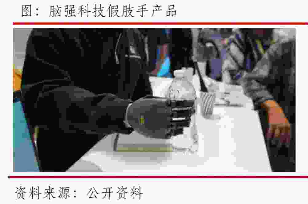 南京假肢公司推荐 - 南京精博假肢和丹阳假肢厂