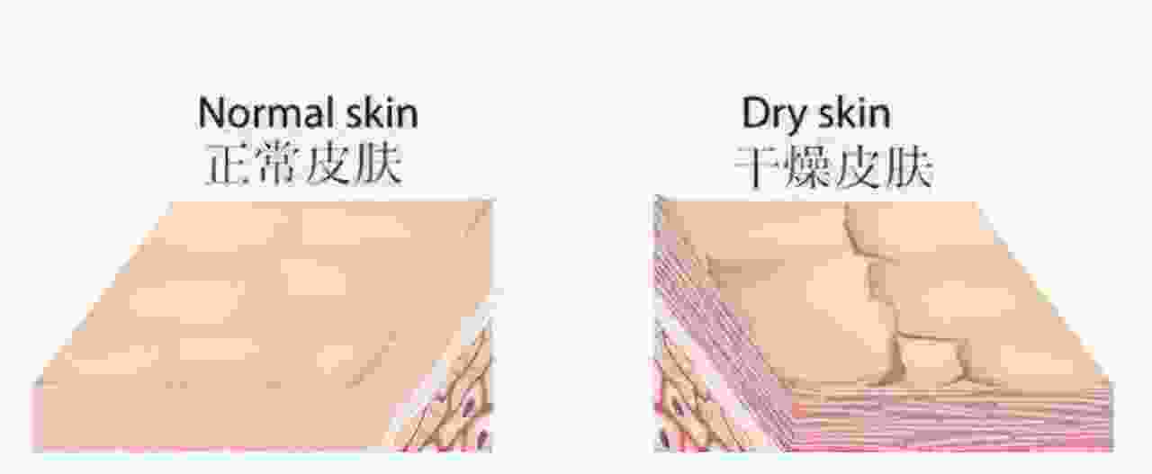 导致你皮肤暗沉缺乏光泽的元凶 肤色暗沉保养秘籍