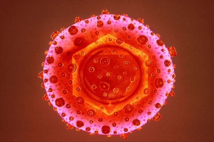 世界十大病毒排行榜