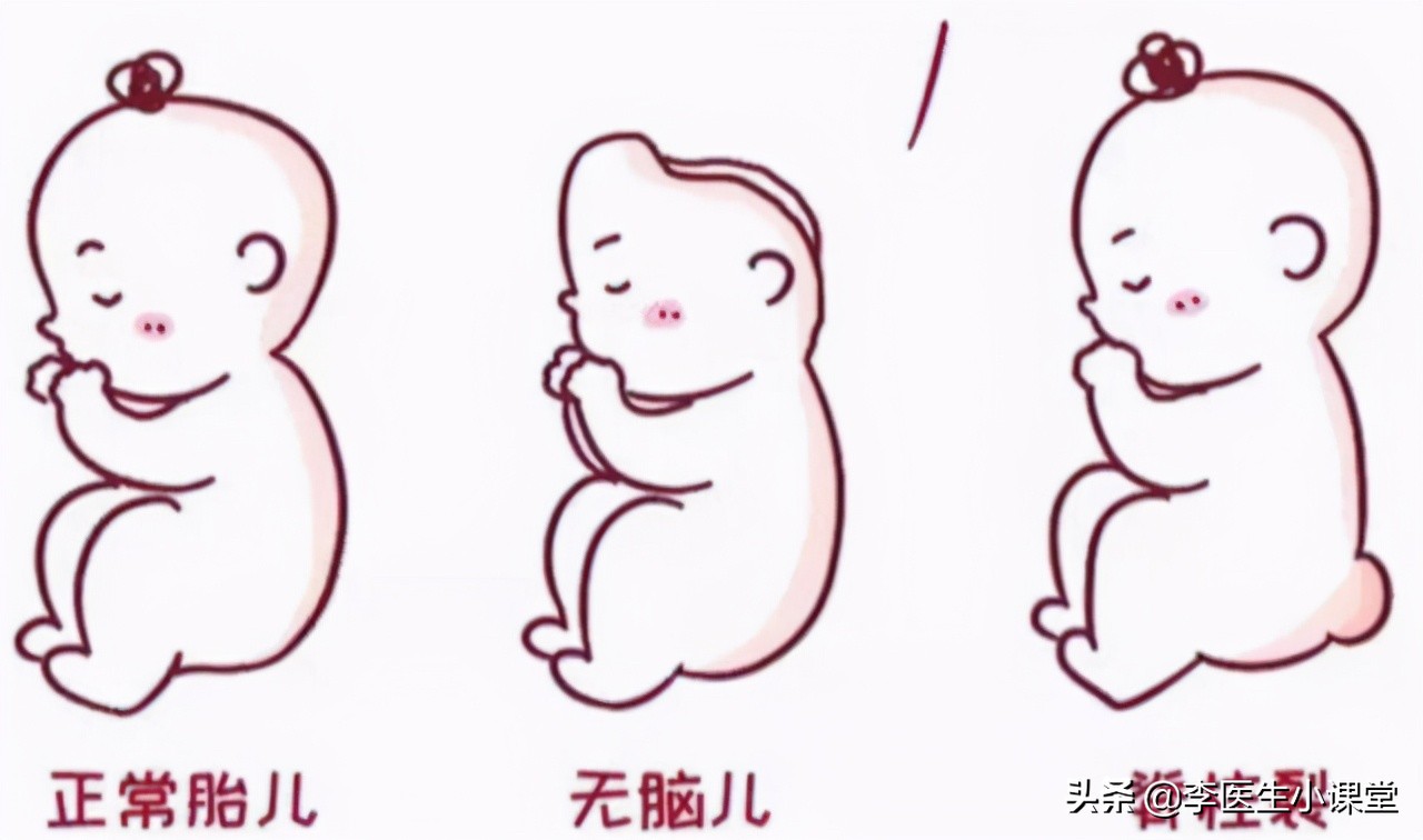 叶酸片能治愈白发吗(正常人吃叶酸的好处)