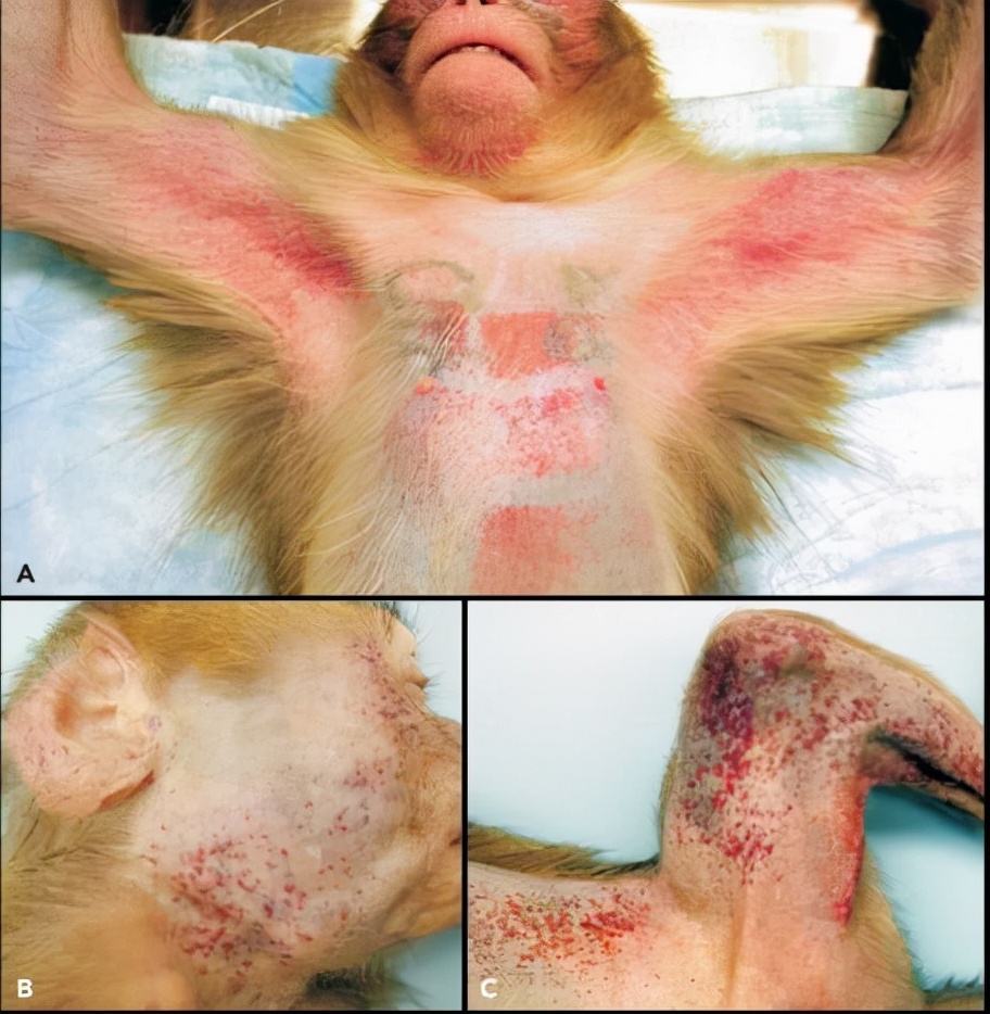 世界十大病毒排行榜