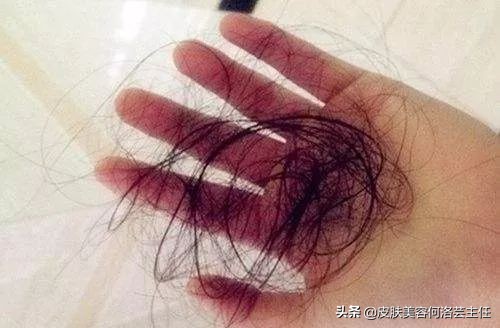 秃顶怎么办用什么能长起来