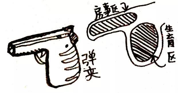 姑娘给男人结扎(女医生主刀做男人结扎例子)