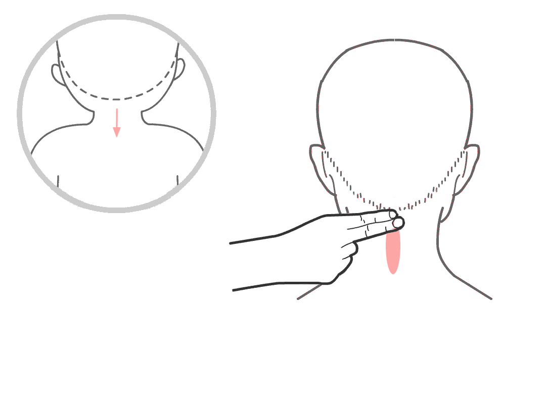小儿高烧39度推拿手法图解（小儿高热退烧推拿手法）