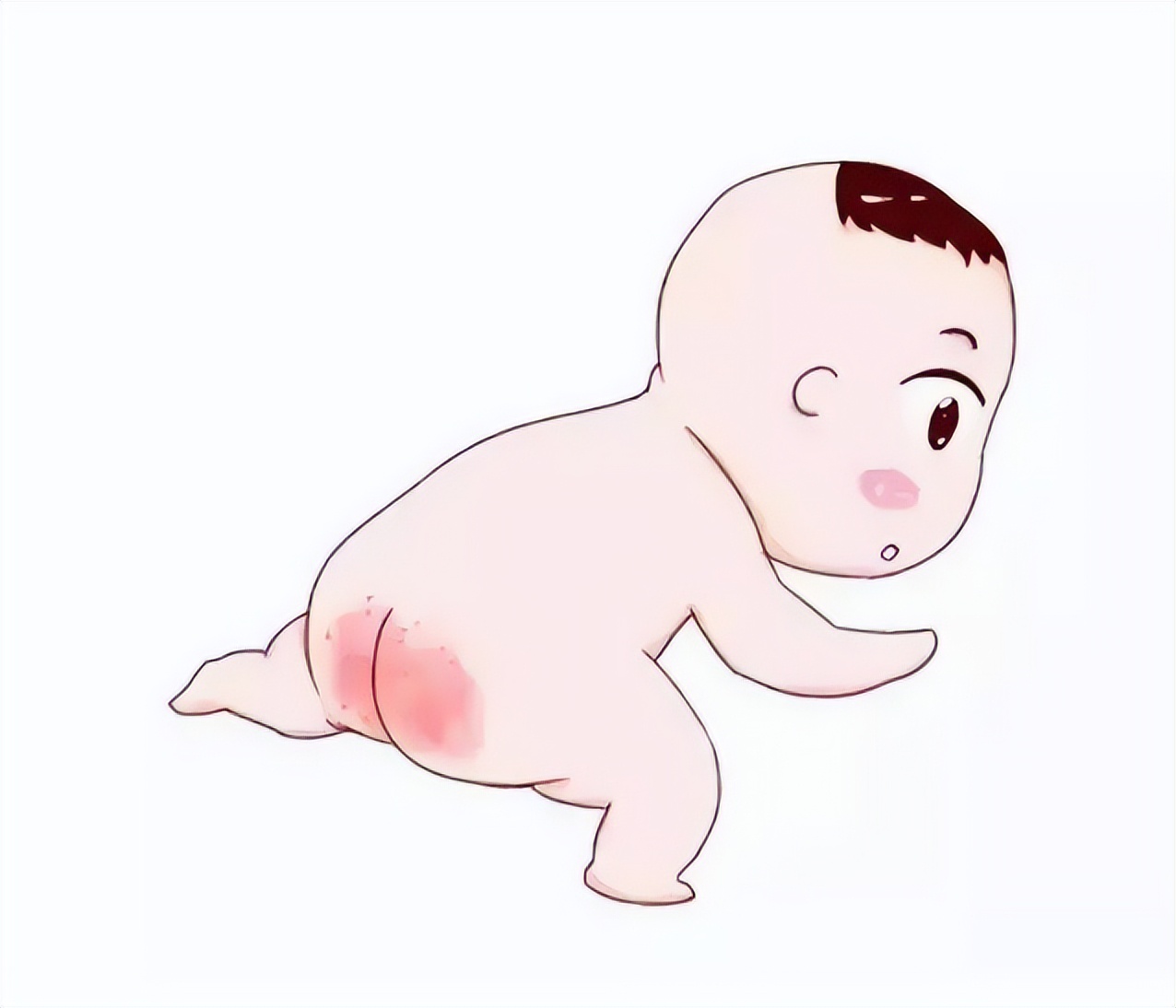 这5种方法教你如何应对宝宝红屁股怎么办(宝宝的红屁股“成灾”)