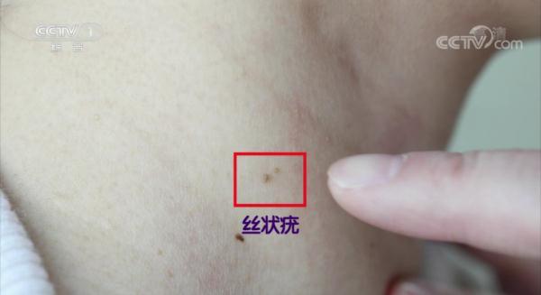 莫名其妙地长在身上