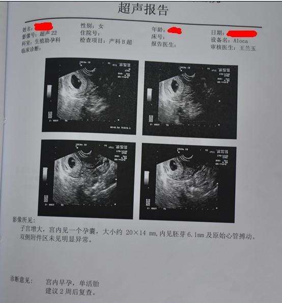 如何知道自己怀的男孩女孩（b超单有这个一般是女孩）