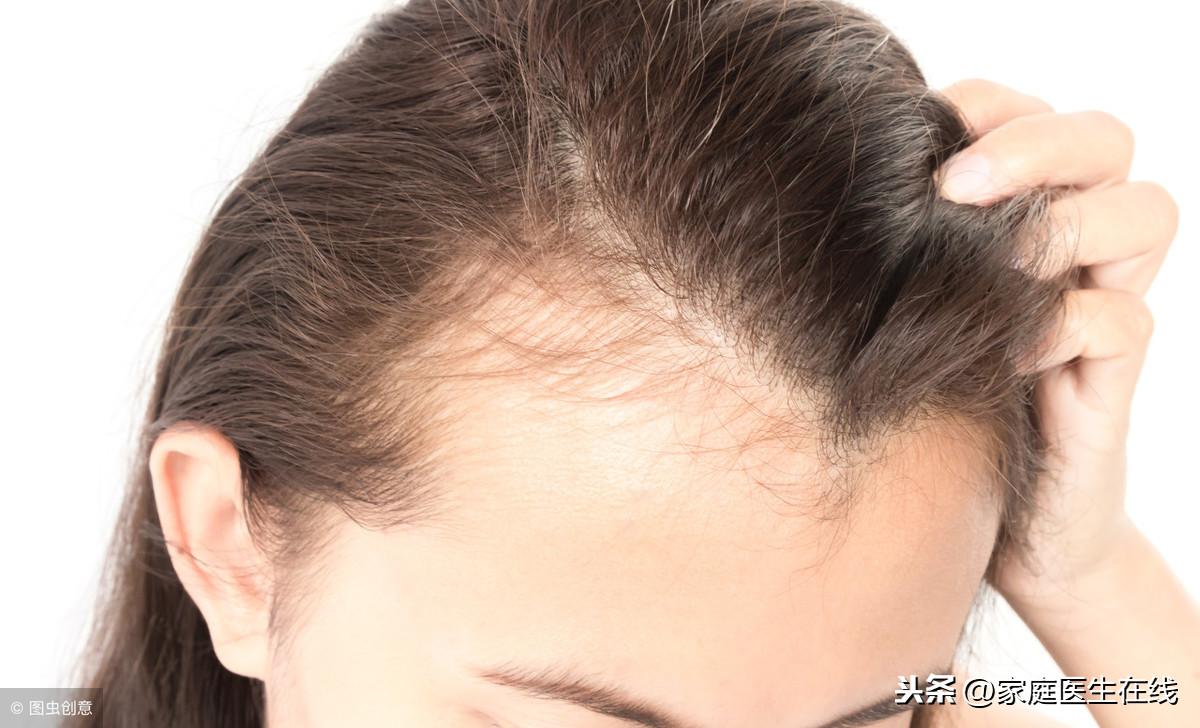 或许能挽救发际线头发一把把的掉（头发掉的厉害怎么办）