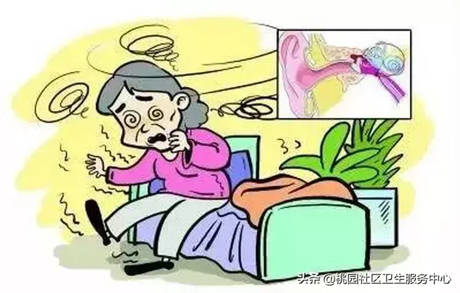 眩晕症症状有哪些表现（眩晕症发作时的症状有哪些）