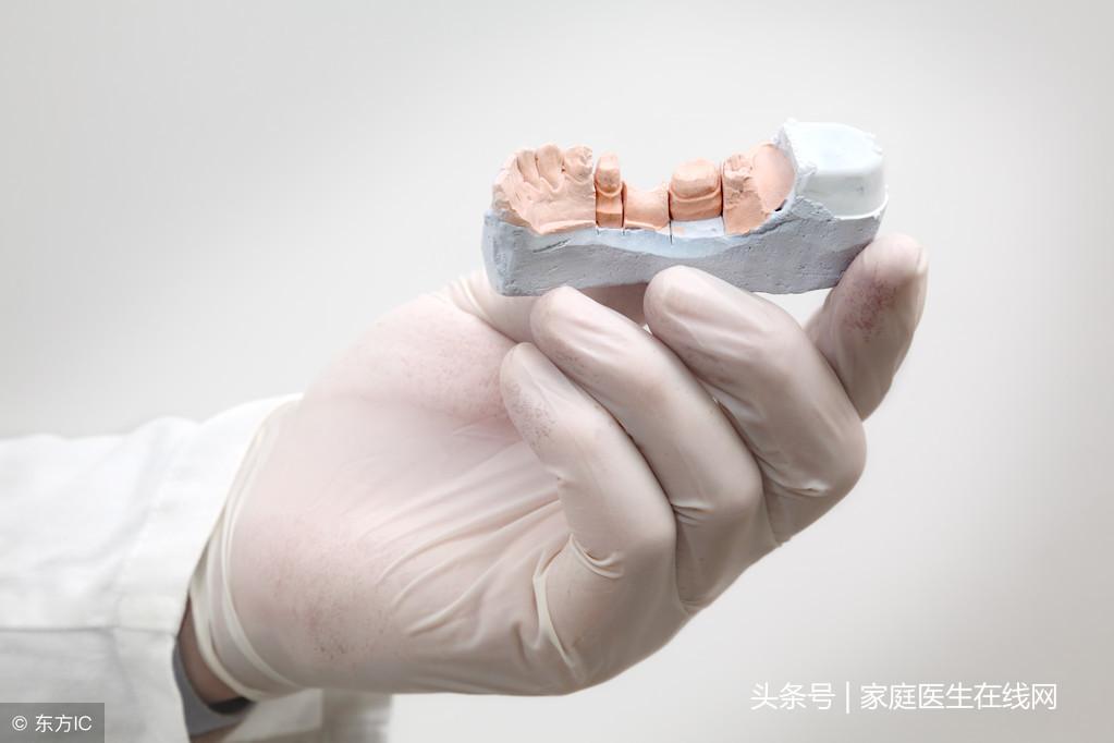 如何去除牙结石(如何去除牙结石)