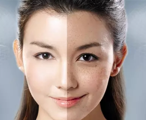 如何快速修掉脸上的斑