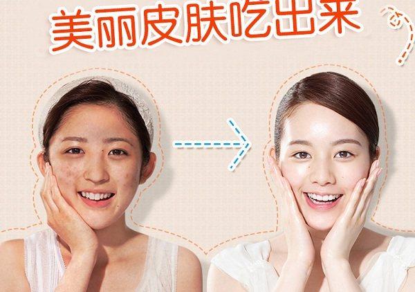 哪种胶原蛋白比较好（胶原蛋白什么牌子好）