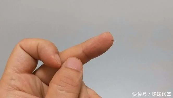 手里扎了个小刺挑不出来怎么办（手上的刺怎么快速出来）