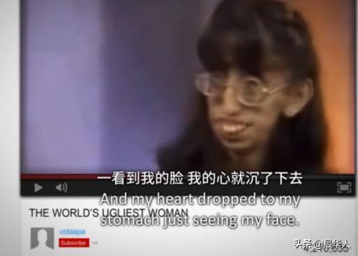 世界最丑的人有多丑（世界上最丑的人叫什么名字）